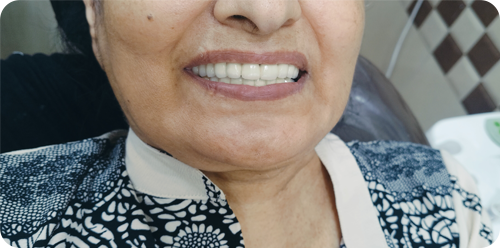 after treatment