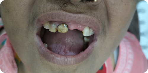 before treatment
