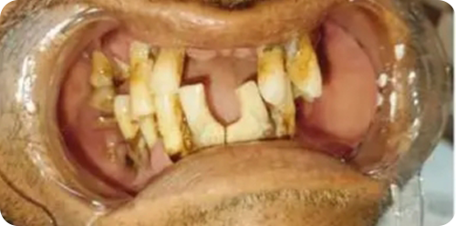 before treatment