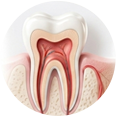 Root Canal Treatment illustration